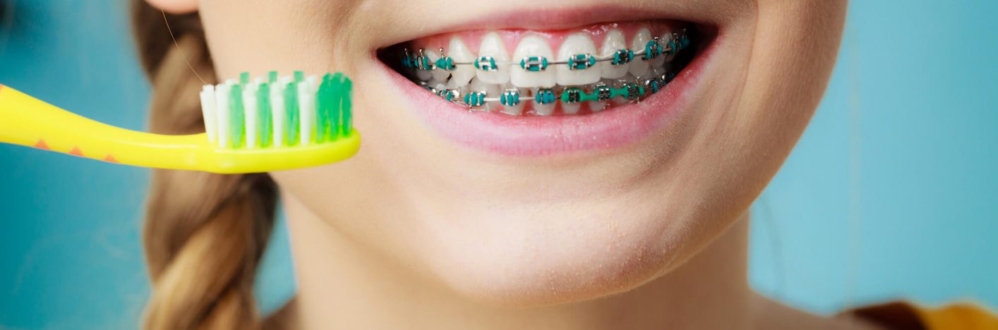 Woman with teeth braces using brush
