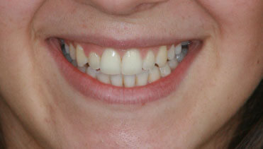 Charlotte Vieira-Martins - After Image
