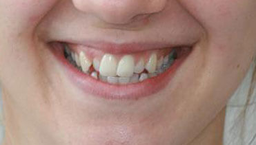 Charlotte Vieira-Martins - Before Image