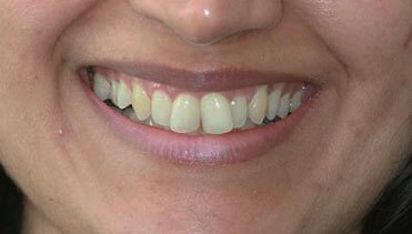 Deepa Chanchlani - Before Image