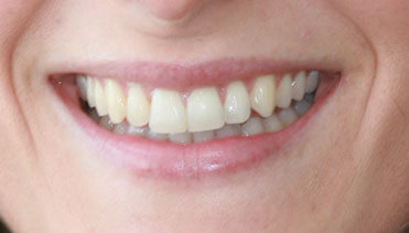 Emma Rumbold - After Image