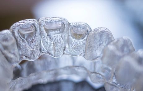 What You Should Know Before Starting Invisalign – Jiva Dental